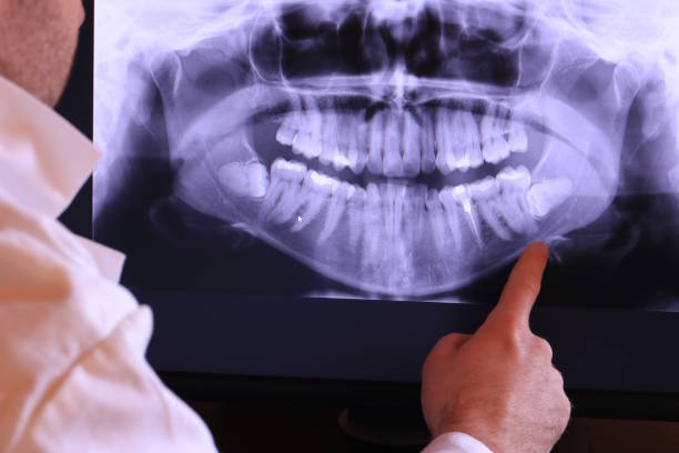 Best Emergency Cosmetic Dentistry in Santa Fe Springs, CA
