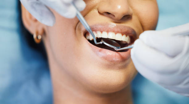 Best Weekend Emergency Dentist in Santa Fe Springs, CA