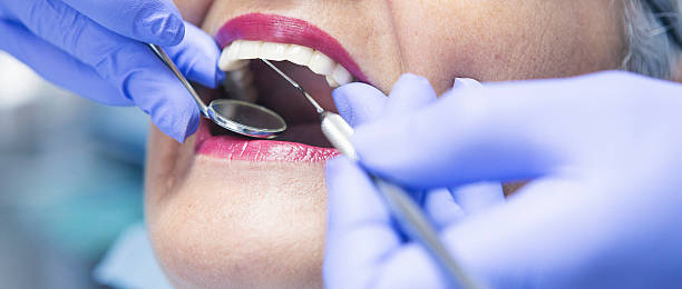 Best Mobile Emergency Dentist in Santa Fe Springs, CA